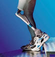 Help Amputees Retain Access to Appropriate Prosthetic Care and Devices!