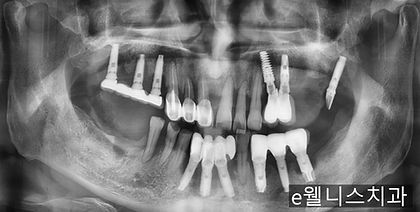 전.jpg
