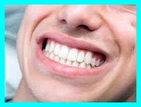 ホワイトニングで白さを保つ方法@大阪梅田メンズ脱毛サロン｜メンズ堂々