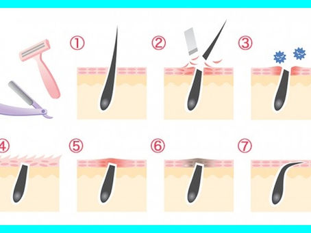 【放っておいたら危険!?】髭剃り後の『黒い点々』は剃り残しではなかった!!! @大阪メンズ脱毛サロン|メンズ堂々