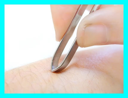 1つの毛穴から毛が2本 毛穴から複数の毛が生える恐ろしい理由とは 大阪梅田メンズ脱毛サロン メンズ堂々