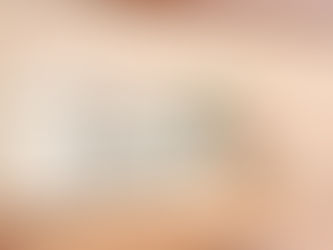- ̗̀ お客様からの質問 ̖́-『脱毛すると汗が増えるって本当?!』