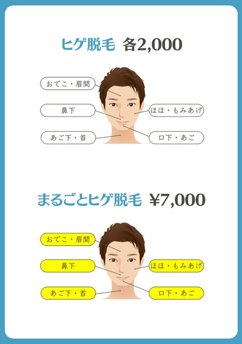 ヒゲ脱毛