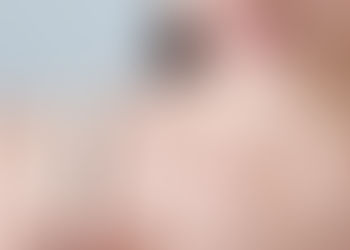 O DIU pode ser um método contraceptivo na adolescência?