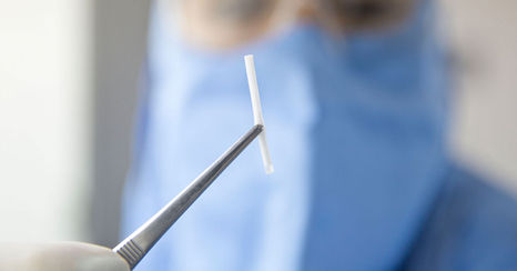 Implante Hormonal: Quem pode usar?