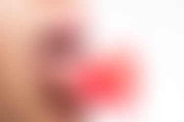 Sexo oral, HPV e Câncer de garganta