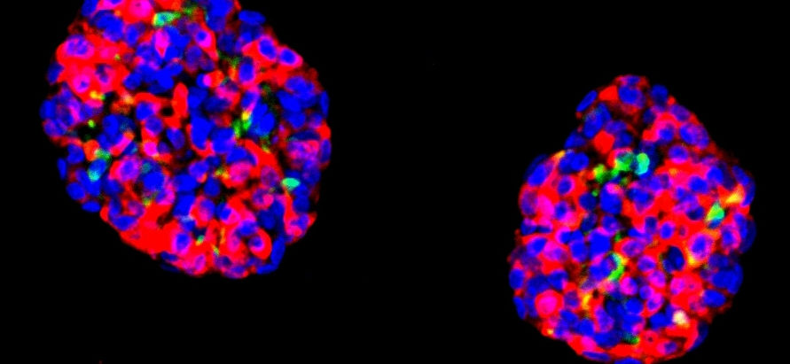 მეცნიერებმა ღეროვანი უჯრედები ინსულინის მწარმოებელ უჯრედებად გარდაქმნეს, რამაც თაგვებში დიაბეტი