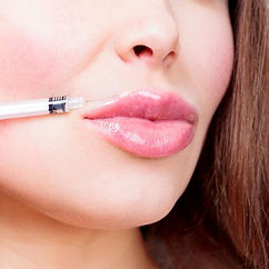 woman receiving a lip filler treatment