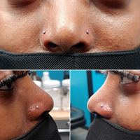 Picture of a double nostril piercing