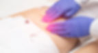 Ovarian-Cyst.jpg