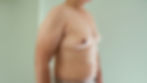 enlarged-breast-tissue-men-risk-of-death-1440x810.jpg