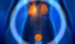 uro1.jpg.webp