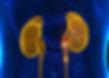 kidney stone inset.jpg
