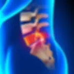 lumbar-discectomy_1200x1200.jpg.webp