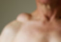 lipoma-example-75f14e.jpg