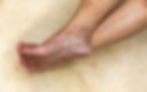 blog-ankle-veins-deeper-problems.jpg