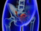 hysteroscopy.jpg