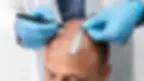 best-place-for-hair-transplant-in-turkey.webp