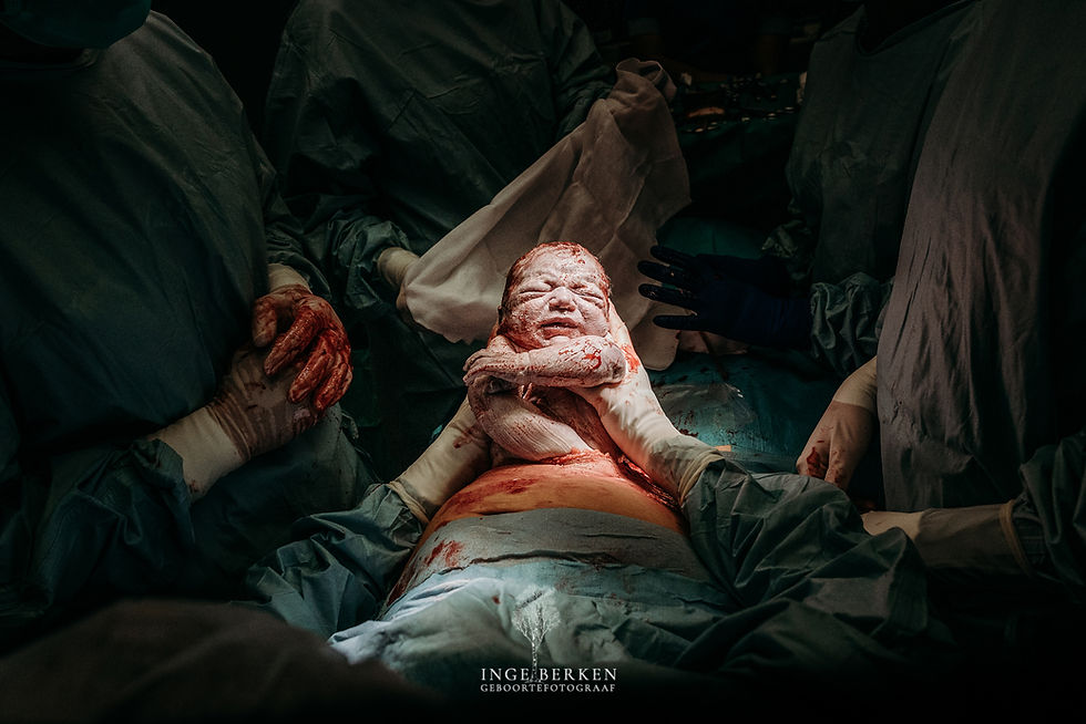 Mother's hands lifting her newborn during a Maternal Assisted Cesarean (MAC) birth, photographed by birth photographer Inge Berken — the Netherlands