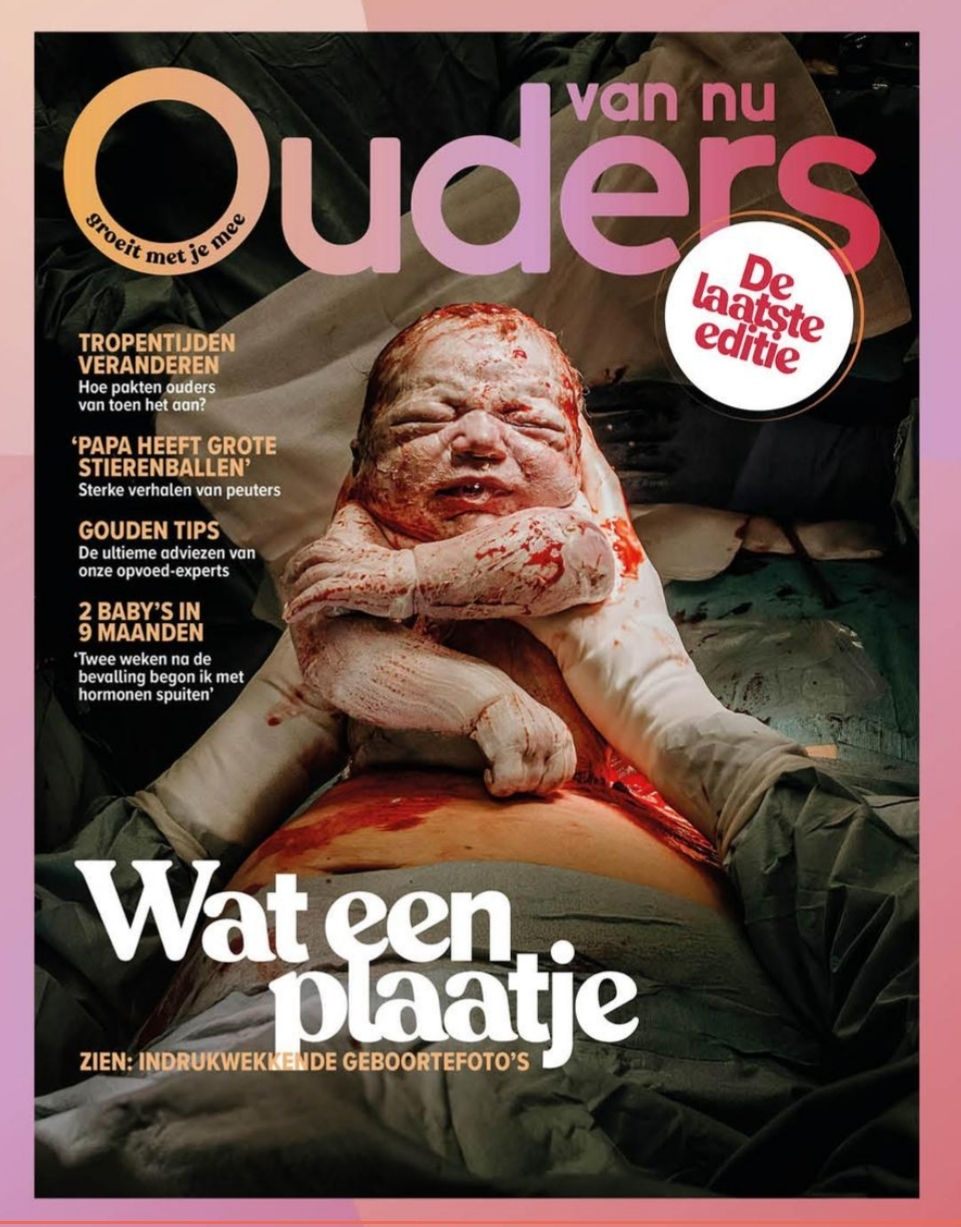 keizersnede, moeder geassisteerde keizersnee, mac, inge berken