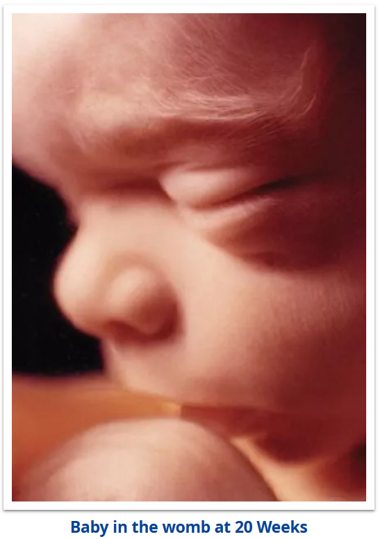 Baby in the womb at 20 Weeks.webp