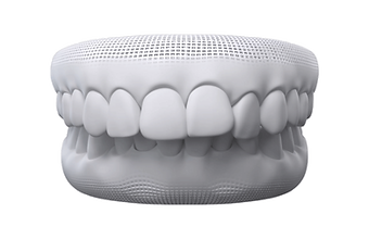 Overbite week one example