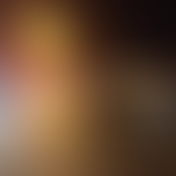 Mulher sofre traumatismo craniano após cair de moto em Testo Central