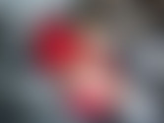 Flatulence, Bloating, and Gas