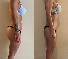 Résultats de perte de poids et tonification obtenus avec le coaching sportif adapté aux objectifs individuels des clients.