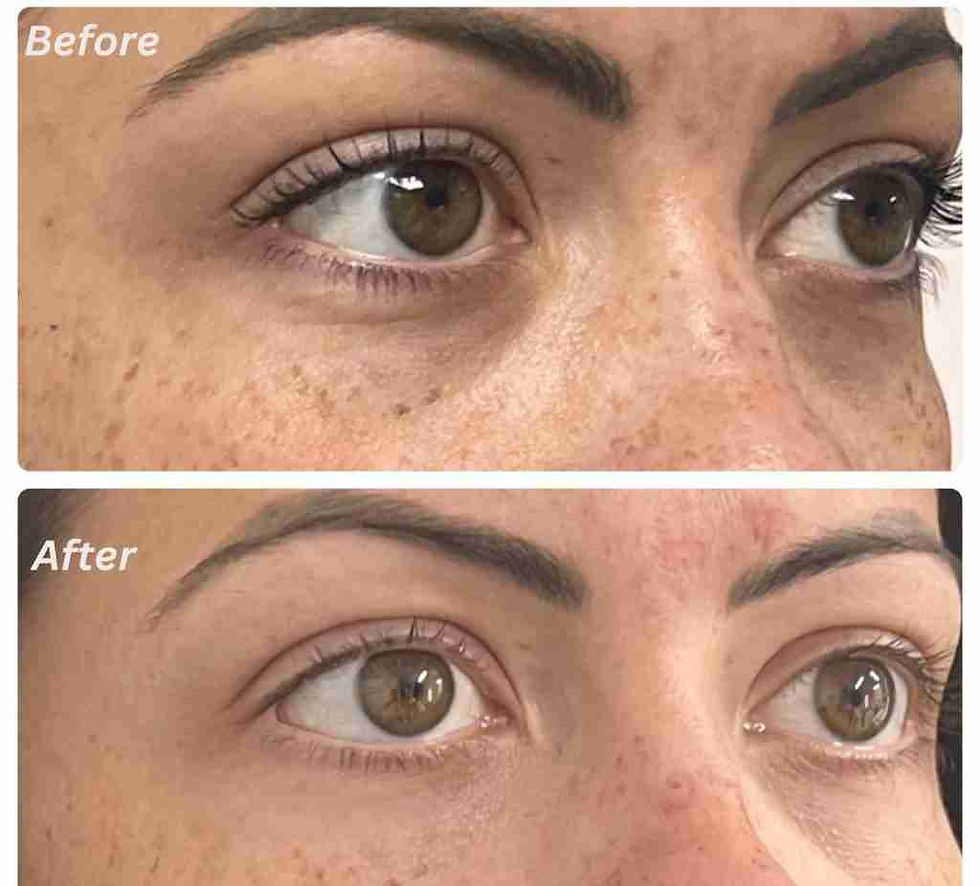 Polynucleotides under eyes: what they can and cannot do