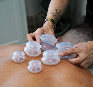 Cupping