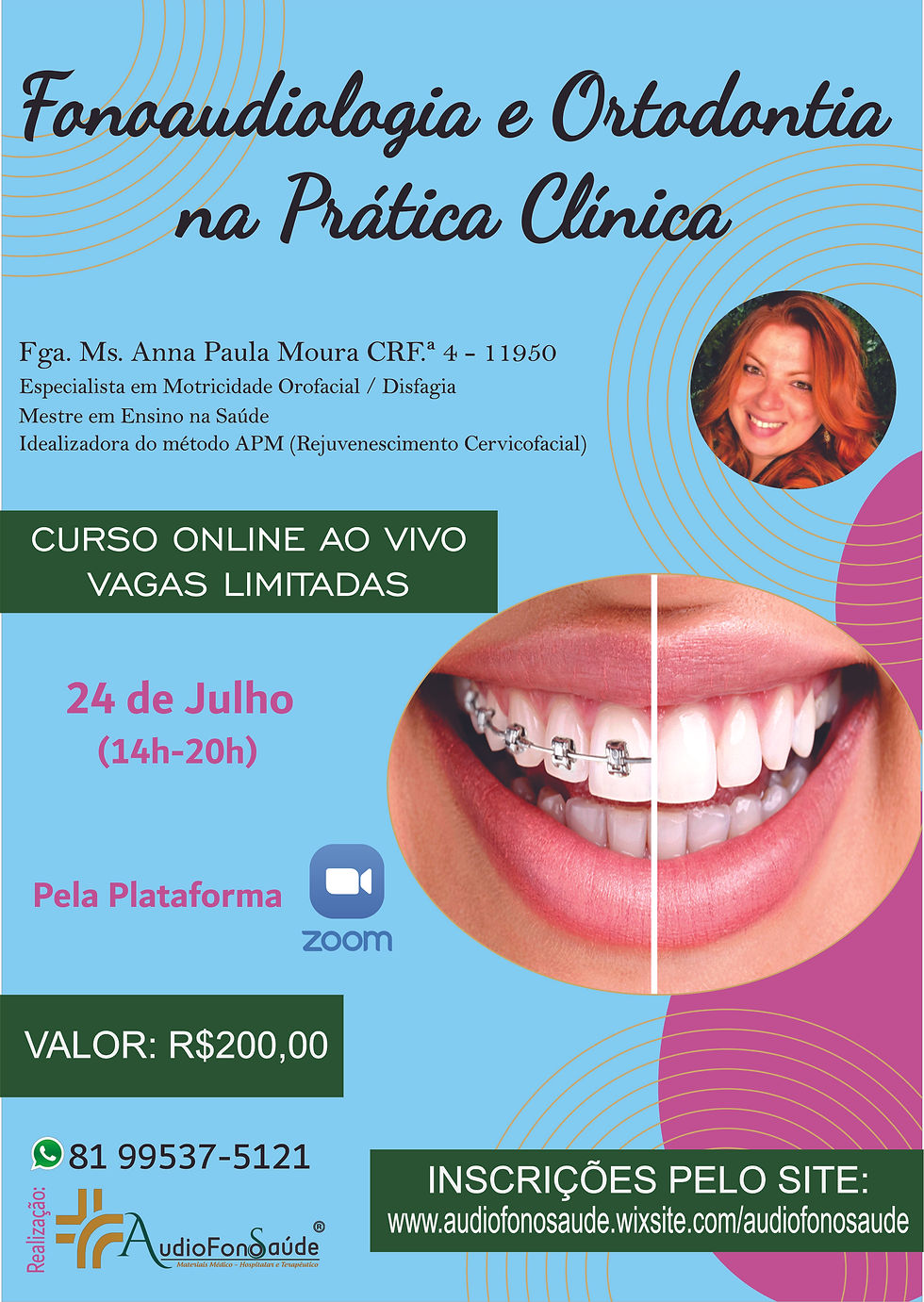 Fonoaudiologia e Ortodontia na Prática Clínica - Online - Ao vivo 2ª Turma 2021