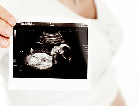 baby-18937_1920_edited_edited.jpg