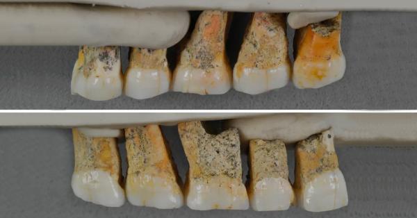 Gigi molar dan premolar milik Homo luzonensis (Dok. Callao Cave Archaeology Project)
