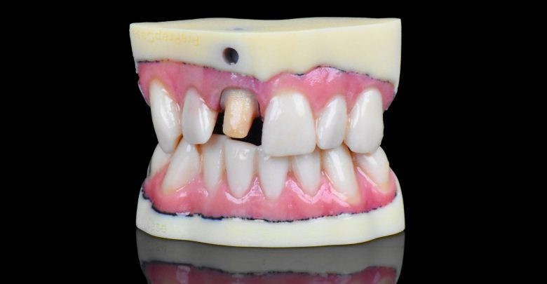 Стоматологический 3D-принтер Stratasys J720 купить