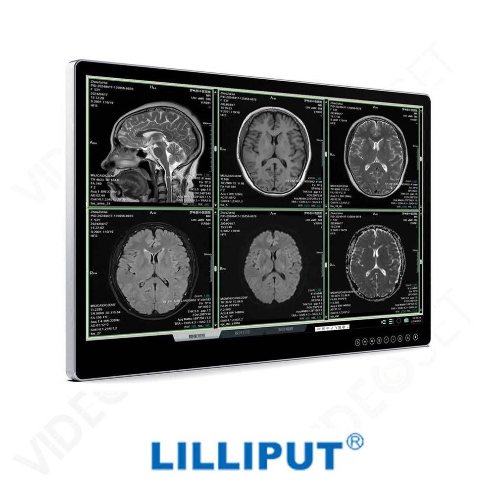 MD31 - Lilliput Aimedik 31.5" UHD 4K Surgical Monitor