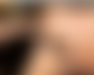 Stress chronique : les signaux que votre corps vous envoie