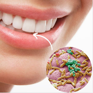 Das Mundmikrobiom: So wichtig ist ein gesundes Mundmikrobiom für unseren Körper und das Immunsystem