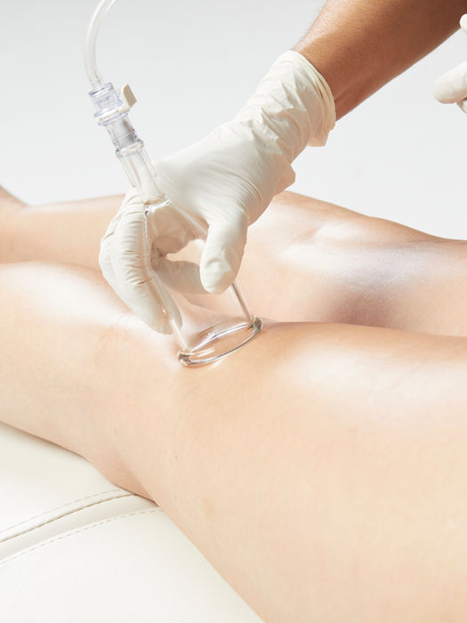 Hydrafacial Behandlung - Body - Beine