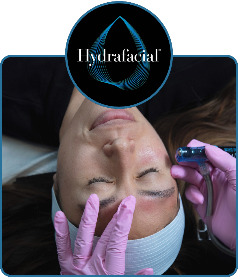 Hydrafacial Behandlung HydraPerk