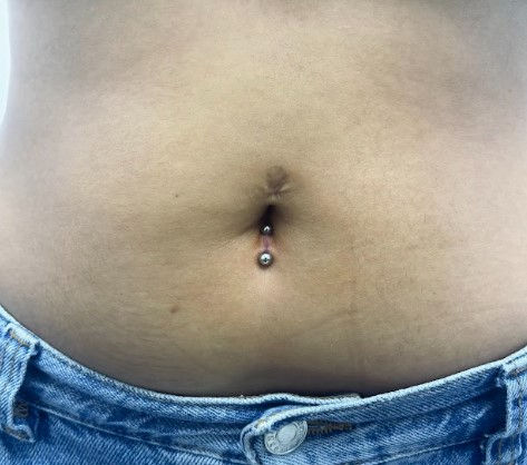 piercing nombril inversé