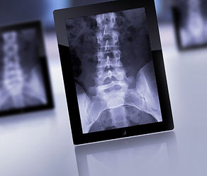 Our Services | Steel Valley Portable X-ray | United States