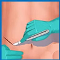 Transplant Surgery 1