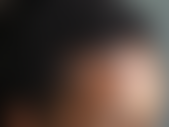 Revolutionizing Hair Care with Mesh Integration for Thinning Hair