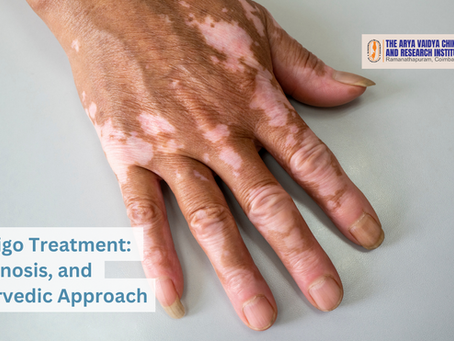 Understanding Vitiligo Treatment: Diagnosis, and Ayurvedic Approach