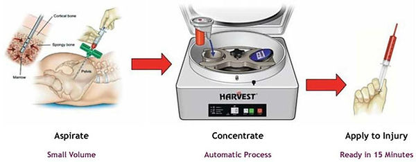 bmac process.jpg
