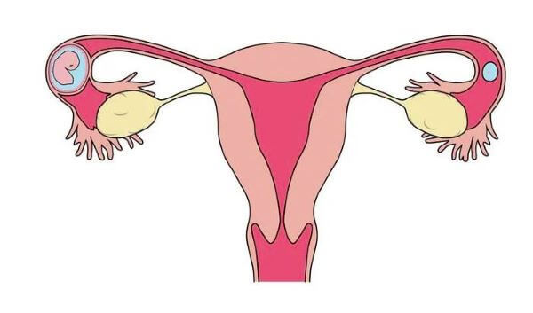 Dangers Of Ectopic Pregnancy: All You Need To Know