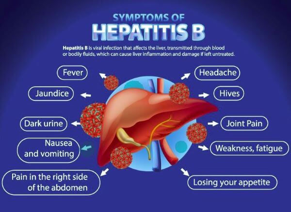 An image showing symptoms of Hepatitis B