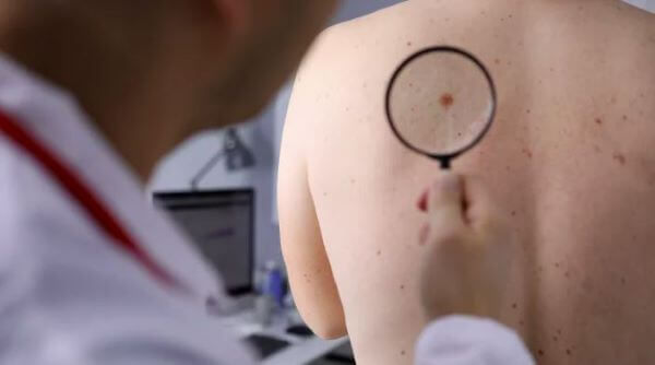 how skin cancer look like