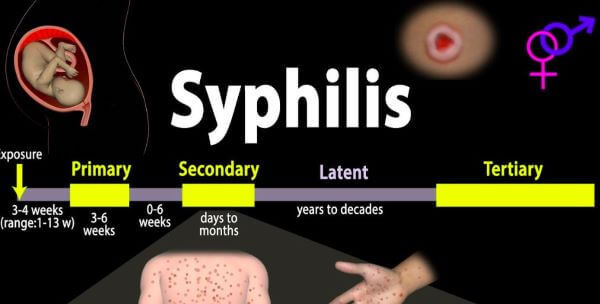 All About Syphilis